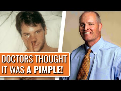 I’ve Had 30 Reconstructive Surgeries Because of Cancer! - Terry | Rare Sarcoma | The Patient Story