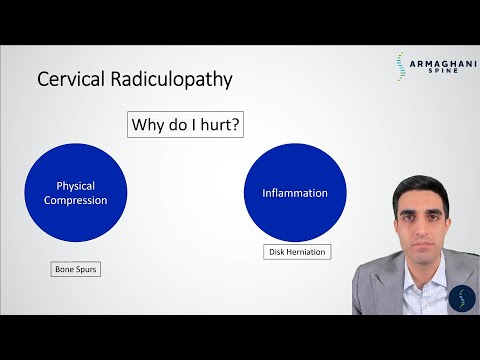 Cervical Radiculopathy - Why do you hurt and what is the plan to get you better?