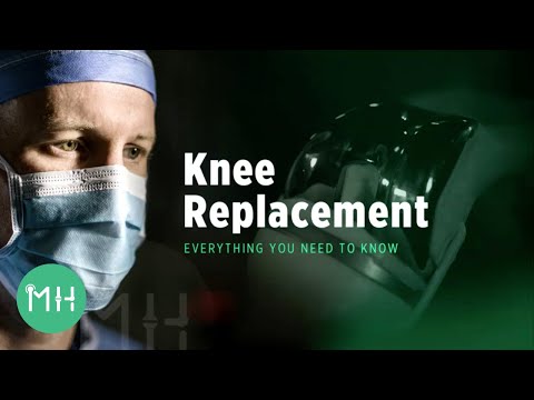 Knee Replacement - Everything you need to know