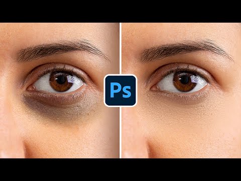Remove Deep Dark Circles Flawlessly in Photoshop!