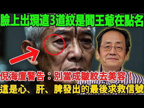 倪海廈： 臉上出現這3道紋，是閻王爺在“點名”！不是迷信，是身體發出的最後求救信號！