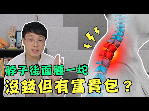 脖子後面腫一坨,到底什麼是富貴包?