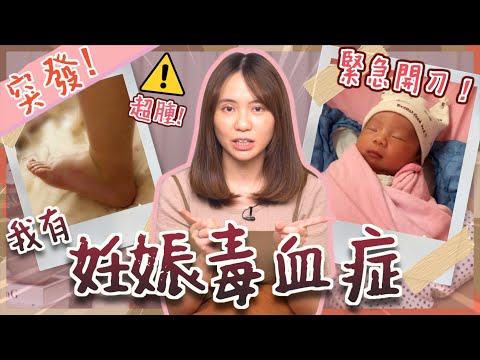 【公立醫院生BB】超驚險!順產變開刀 😭 妊娠毒血症緊急開刀經歷|屯門醫院生產手術聽住謝安琪林家謙😂|懷孕水腫要小心|剖腹生產勁痛?|生產日記|生產紀錄|產檢的重要