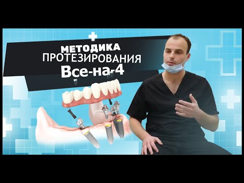 Концепция «Все на 4» all on 4 - руководство пациента.