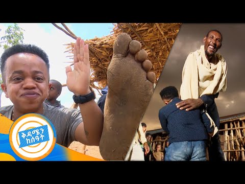 "በህይወቴ ለመጀመሪያ ጊዜ ጫማ አደረግኩ" ቁመተ መለሎው ጐልማሳ ጫማ በልኩ ተገኘለት .../በቅዳሜን ከሰአት/