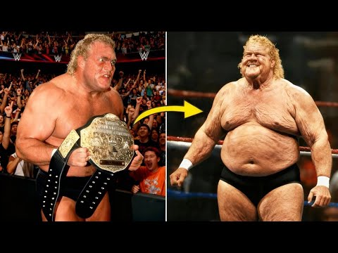 10 WWE-Wrestler mit deutlich verschlechtertem Aussehen nach dem Karriereende