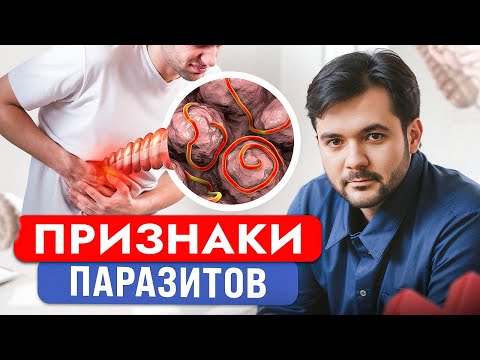 Этот СПОСОБ 100% Убьет Всех Паразитов в Вашем Организме!