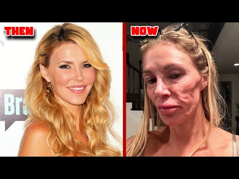Real Housewives Plastic Surgery Gone Horribly Wrong!