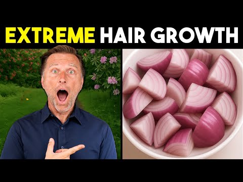 Onion Juice for Extreme Hair Growth: Stop Hair Loss