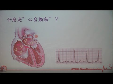 2022年 第二屆-I 心房顫動知多少?  by 游治節醫師