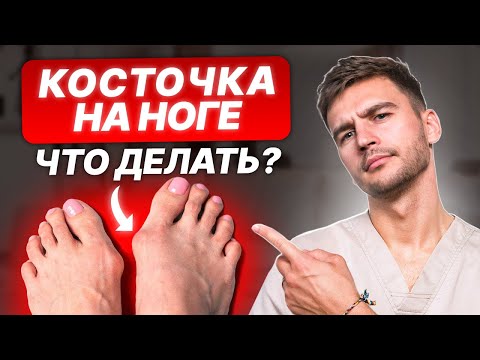 Вальгус влияет на то, как ты выглядишь! Как избавиться от косточки на стопе?