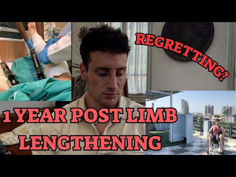 DO I REGRET GETTING LIMB LENGTHENING? (1 year later)