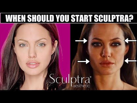 When should You Start Sculptra? Signs you Should Start NOW