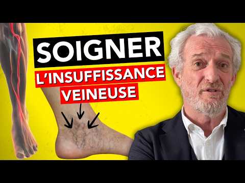 L'EXPERT des VEINES alerte sur L'INSUFFISANCE VEINEUSE [Dr Néaume]