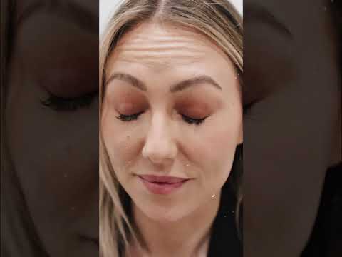 Why Your Eyebrows Matter for Eyelid Surgery! #shorts