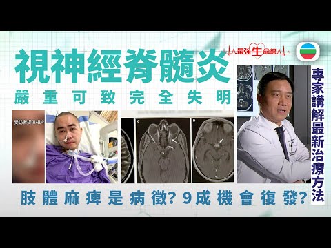 TVB最強生命線｜視神經脊髓炎 (繁 / 簡字幕)｜醫療｜治療｜無綫新聞｜TVB News