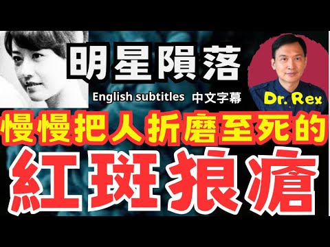 周海媚猝死，究竟紅斑狼瘡是一種如何可怕的疾病？What is lupus and how horrible is it?