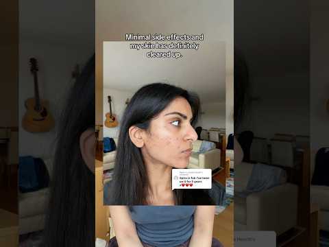 spiro seems to be working for me so far too! #skincare #acne #dermatology #spiro