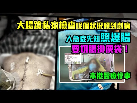 東張西望｜醫療慘事｜大腸鏡私家檢查呢個狀況照到劇痛　入急症先知照爆腸要切腸掛便袋！｜大腸鏡｜入急症｜爆腸要切腸掛便袋｜梁敏巧
