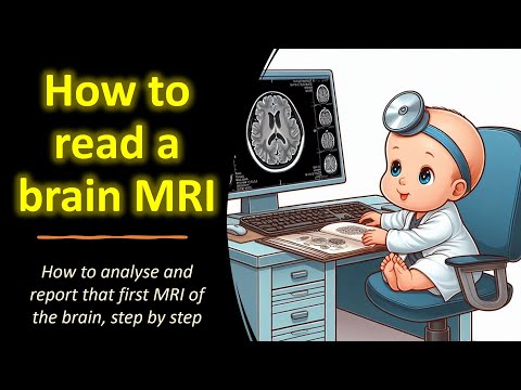 How to read an MRI of the brain?