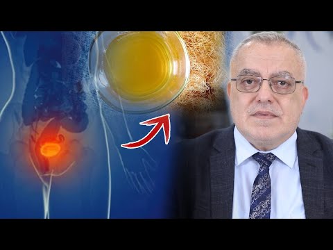 أقوى علاج طبيعي  لحرقة وألام الجهاز البولي كثرة التبول وعسر البول حرقان مصاحب للتبول تضخم البروستات