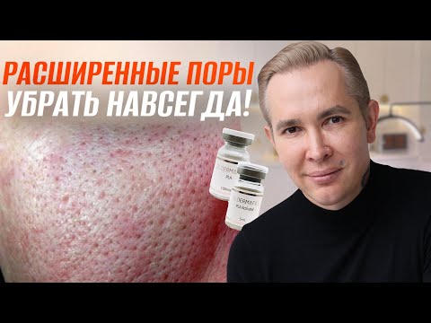 РАСШИРЕННЫЕ ПОРЫ Как избавиться в домашних условиях? САМЫЙ ДЕЙСТВЕННЫЙ СПОСОБ #mesomatrix