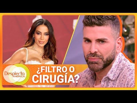 Jomari Goyso opina de Anitta en polémica por unas fotos de su rostro | Despierta América | 18 dic
