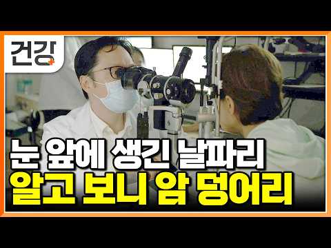 어느 날 눈앞에 나타난 작은 점과 뿌연 안개, 내 시력 앗아갔다｜생소해서 더 무서운 안구 종양｜다른 장기로 전이 되는 맥락막 흑색종｜명의｜#EBS건강