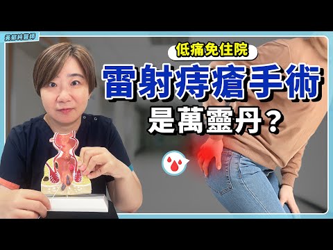 痔瘡手術怎麼選？認識最新黑科技「雷射消融」