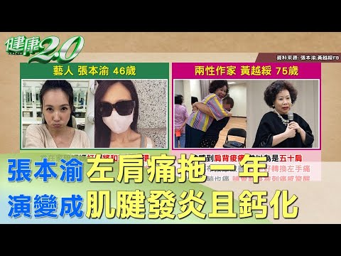 張本渝左肩痛拖一年 演變成肌腱發炎且鈣化 健康2.0