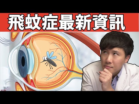 最完整飛蚊症線上課程! 一切你需要知道的資訊: 飛蚊症治療與改善!