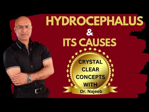 Causes of Hydrocephalus | What is going on in the brain | Dr Najeeb