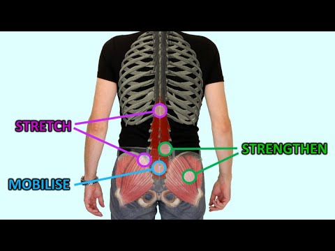 6 Essential Exercises For Back Pain Relief & Prevention