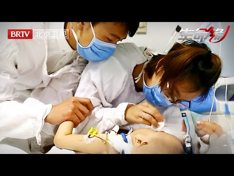 两岁男童全身长了300颗肿瘤，脖子肿胀得像个气球，极力抢救却在生日前夕离世，医生崩溃大哭，父母含泪捐赠器官【生命缘第4季】