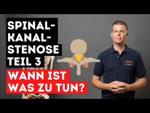 Spinalkanalstenose - Therapiereihenfolge - Was besonders wichtig ist - Teil 3