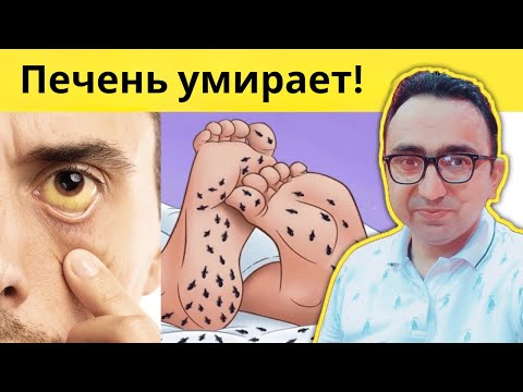 Ваша печень умирает! 9 ранних признаков повреждения печени, которые врачи часто упускают из виду