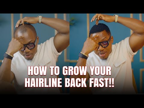 How to grow your hairline fast!