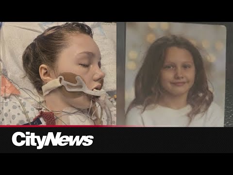 Tumbler Ridge survivor's condition still critical but improving