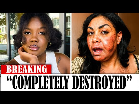 20 Black Actors Who RUINED Their Careers With PLASTIC SURGERY