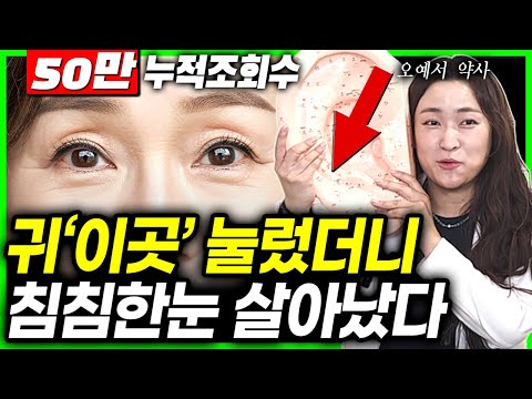 "치료 성공사례" 백내장 수술없이 막았어요! 장소 상관없이 하루 1분. 뿌옇고 침침한 눈 맑아지는 이 방법 | 오예서 약사 | 가장 간단한 시력개선