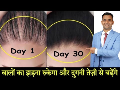 दुगनी ( 2x ) तेजी से बडेंगे बाल | Stop Hair Fall And Promote Hair Growth | बालों का झड़ना रोके