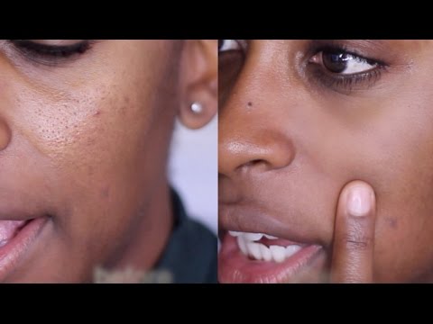 How To Minimize LARGE PORES! #FixitFriday | Jackie Aina