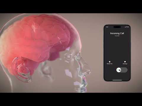 Neuralink’s Clinical Trial