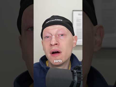 Nikki Glaser On Plastic Surgery