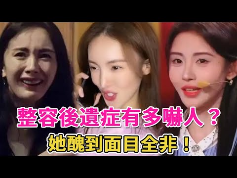 Quack 240716 sequelae 2