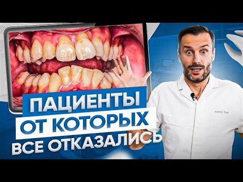 Самые кривые зубы: от этих 5 пациентов отказались все… Кроме нас! Результаты ДО и ПОСЛЕ
