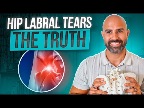 CAN A LABRAL TEAR HEAL WITHOUT SURGERY? THE TRUTH FROM THE HIP PHYSIO