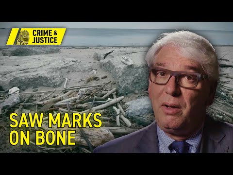 Severed Leg Found Under Burlington Bridge Toronto