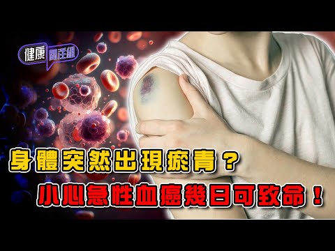 身體突然出現瘀青？小心急性血癌幾日可致命！｜ 健康關注組 ｜ EP406 ｜ 血癌 ｜ 白血病 ｜敖嘉年 ｜ 麥詩敏 ｜ HOY TV 77台