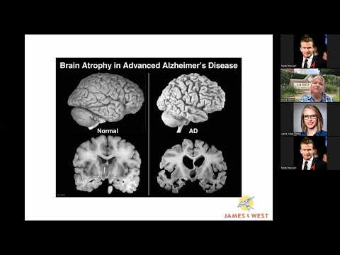 Caring for Someone in the Middle Stages of Dementia